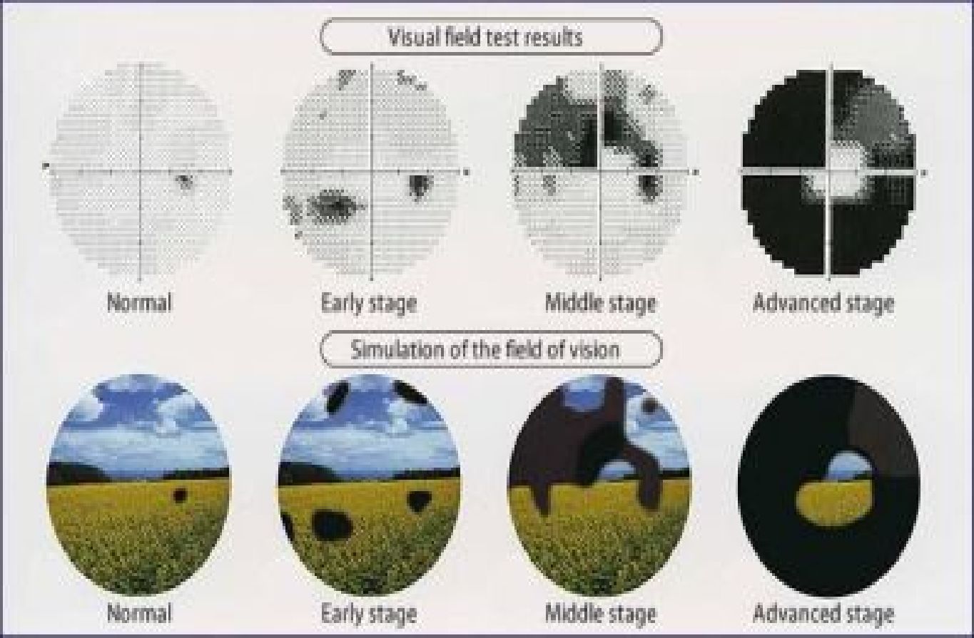 Vision types - near, intermediate and far vision illustration